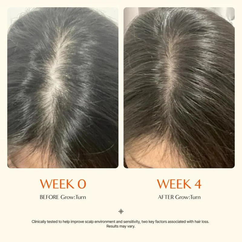 Advanced Hair Growth Serum with Precision Brush - Image 2