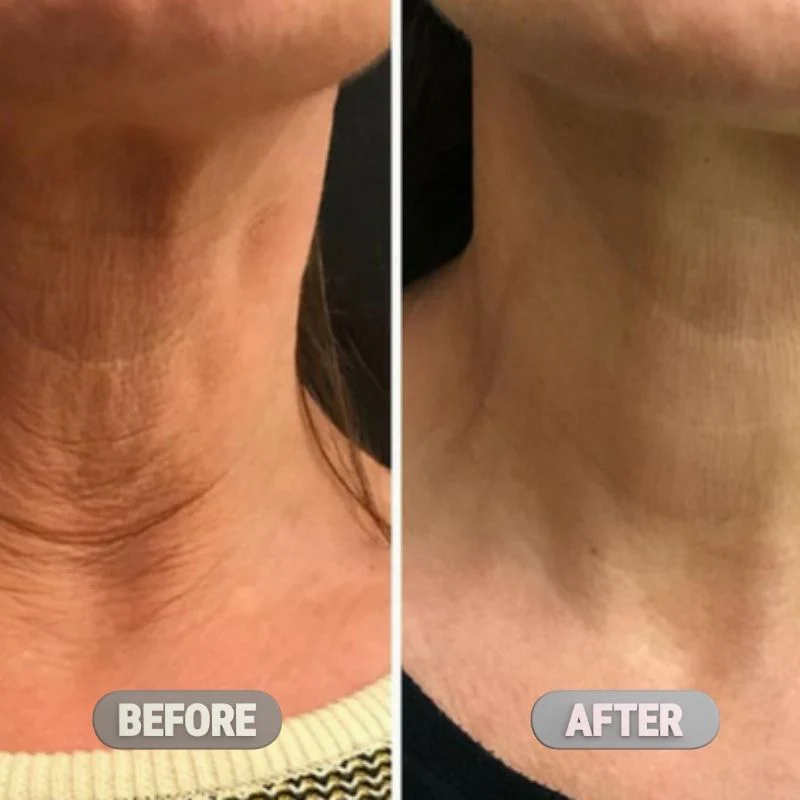 Korean Clinical Neck Rejuvenation Trio - Image 2